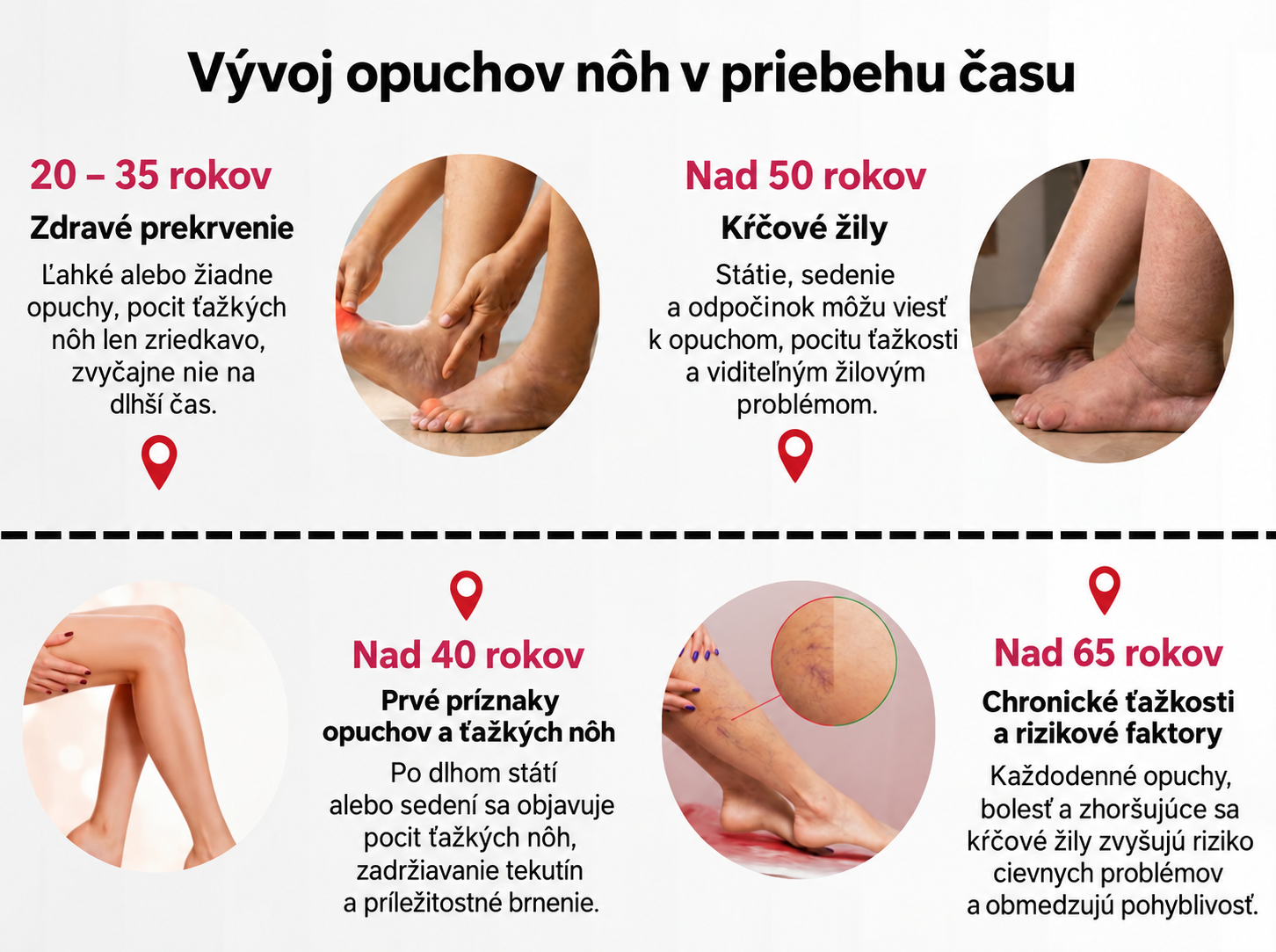 Časová os zdravia nôh